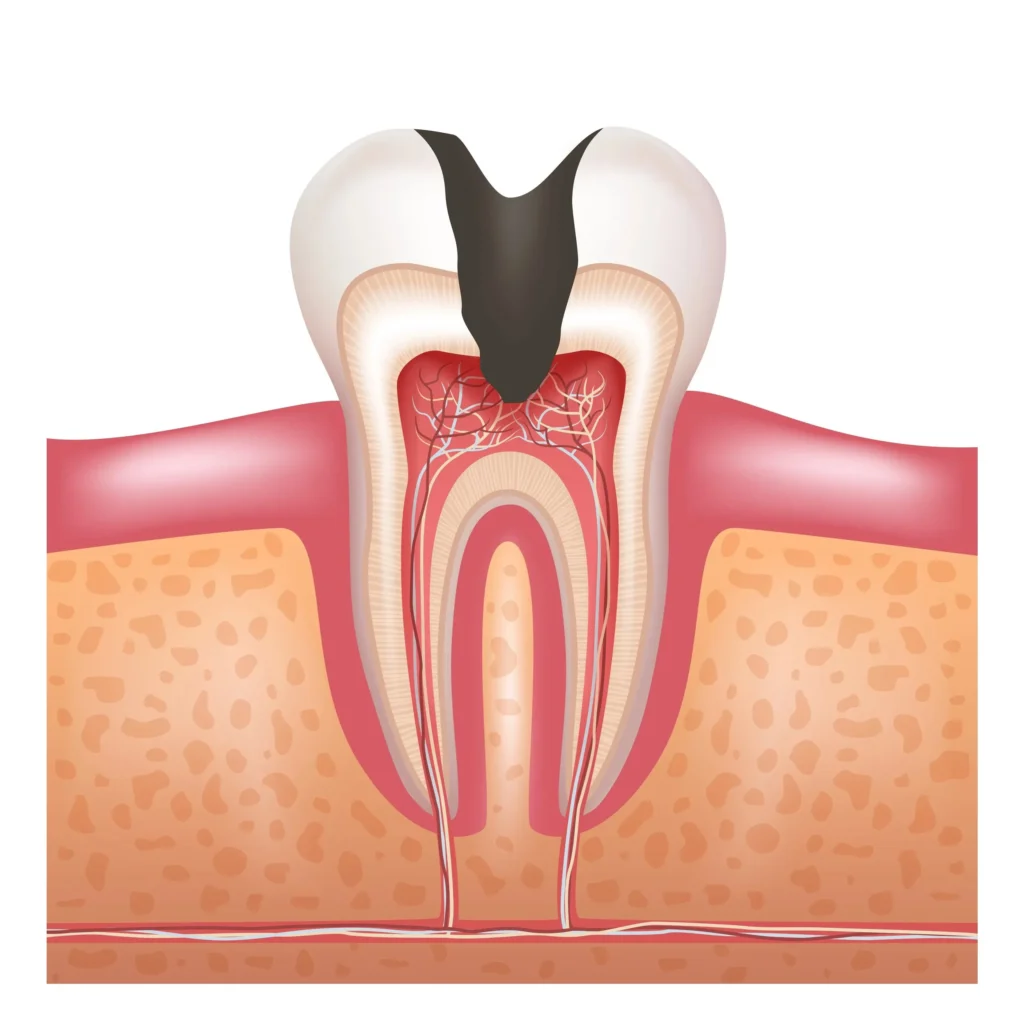 Healthier+Oral+Environment Healthier+Oral+Environment